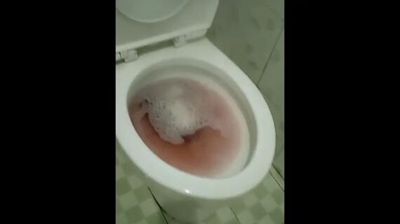 Cara Mudah Mengatasi WC Mampet by Ekky